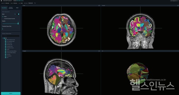 뷰노메드딥브레인®운영화면예시