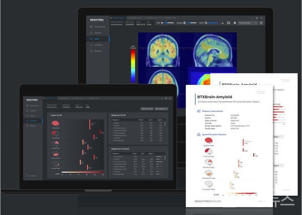 (주)브라이토닉스이미징이개발한‘AI기반아밀로이드PET자동정량분석소프트웨어BTXBrain’화면