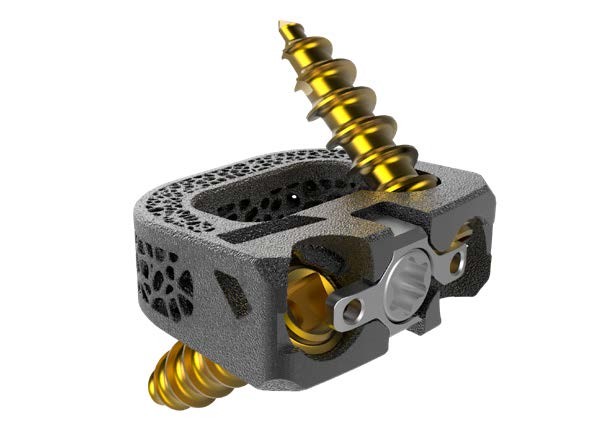 이노시스의경추수술용케이지유니스페이스스탠드-얼론씨케이지(UniSpace®Stand-AloneCCage)의모습