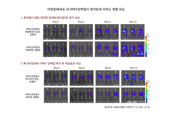 자연살해세포내HPK1단백질이전이암에미치는영향비교
