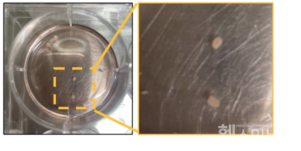 뇌수막종오가노이드모델