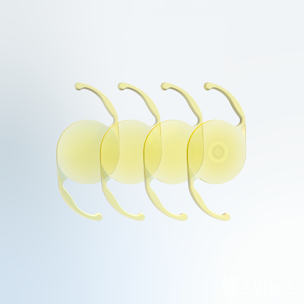 클라레온기술로완성된인공수정체포트폴리오.(한국알콘제공)