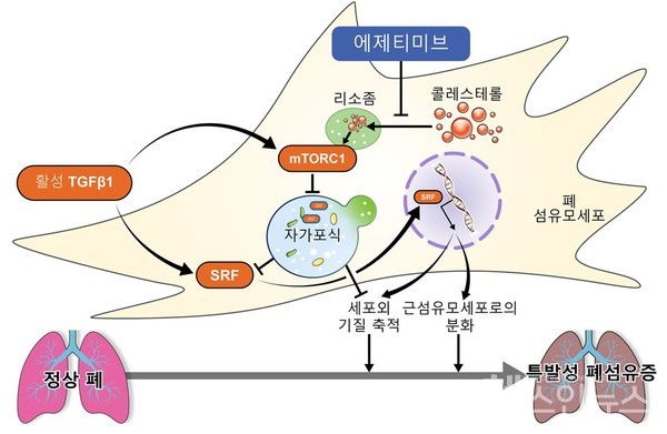 에제티미브가폐섬유화를억제하는과정