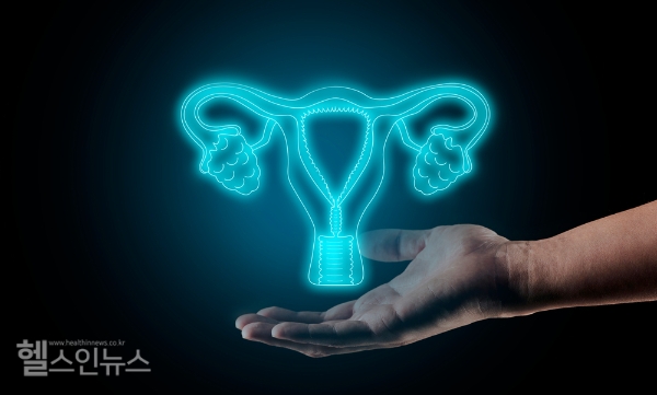 일부 대장암 환자에서 보이는 린치증후군, 자궁내막암·난소암 등 부인암 진단 확률 높아져 (클립아트코리아)