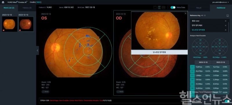 뷰노메드 펀더스 AI 운영화면 예시 (뷰노 제공)