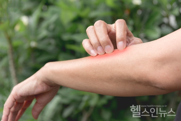 질병관리청,지난 7월 25일부터 전국 일본뇌염 경보 발령... 감염 시 가벼운 증상 나타나지만 드물게 심각한 증상 및 사망에 이르게 만들 수 있어 각별한 주의 필요해 (클립아트코리아)