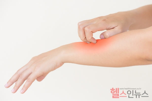 건강한 여름을 위해 알아둬야 할 말라리아 대처법, 사람간 전파 불가피... 격리 필요 없지만 말라리아 환자 3주 정도 주의해야 (클립아트코리아)