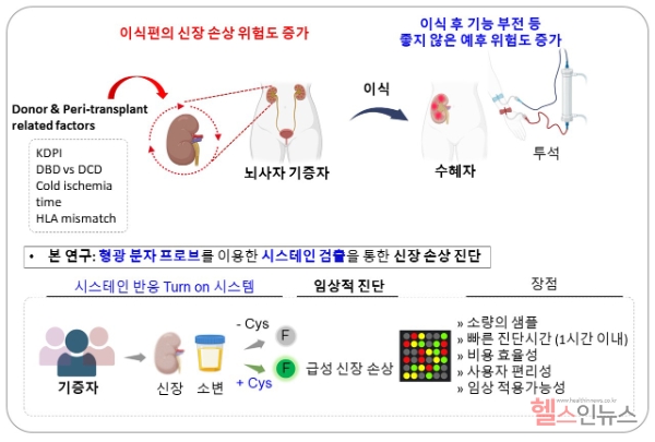 시스테인 수치를 감지하는 형광 분자 프로브를 활용한 신장 손상 진단