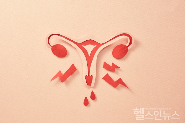 40세 이전부터 6개월 이상 무월경 있다면 '조기폐경' 의심... 안면홍조, 야간 발한, 불면증, 기분 변화, 요실금 등의 증상 동반하기도 (클립아트코리아)