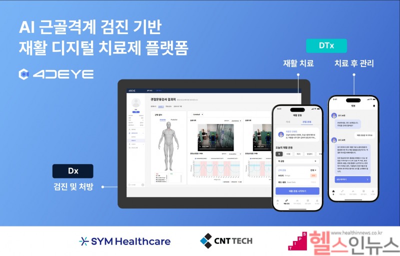 SYM헬스케어 4DEYE 안내 포스터 (SYM헬스케어 제공)