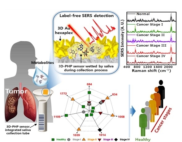 침을 이용한 폐암 진단 기술(재료연 제공)