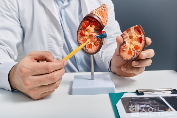 여름철 환자 수 늘어나는 급성 콩팥손상, 일반적인 사망률 40%... 외상 후에는 60~70%까지 치솟는 위험한 질환. 의심 증상 있으면 바로 의료진 찾아 검사 받아봐야 (클립아트코리아)