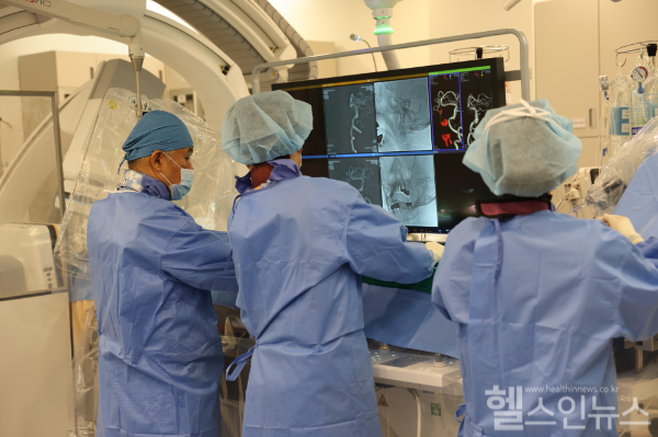 전평 교수가 최신 뇌동맥류 스텐트 장비를 사용하여 시술하고 있다 (삼성서울병원 제공)