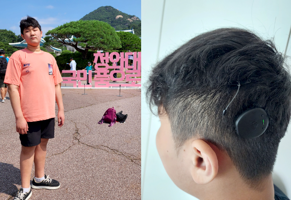 외부장치를 교체하고 언어발달이 향상된 김새민(가명, 13세) 아동