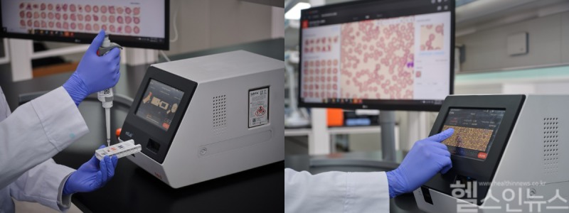 AI 의료기기 개발기업 노을의 말라리아 분석 보조용 소프트웨어 기기와 카트리지를 이용한 실험 결과 확인 모습 (노을 제공)