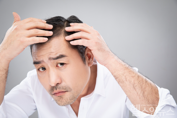 생명을 위협하진 않지만 그만큼 삶의 질을 뚝 떨어뜨리는 대표적인 현대인들의 질환 탈모. 탈모의 원인부터 증상 그리고 치료법까지 알아보자 (클립아트코리아)