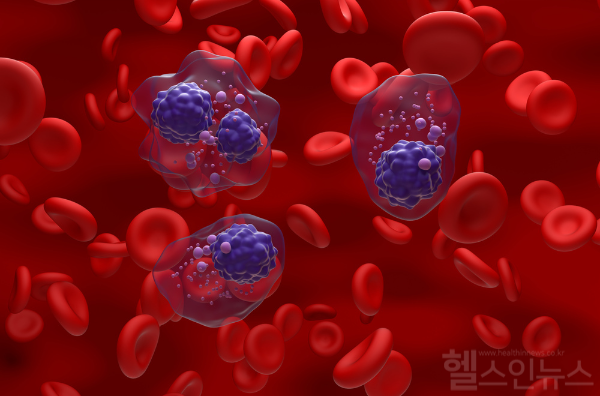 위암, 장내균총 '항 종양 효과' 확인... 향후 여러 암 질환 치료에 응용 가능성 열려 (클립아트코리아)