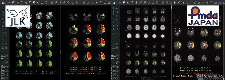 제이엘케이 뇌졸중 솔루션 'JLK-CTP, JLK-PWI' 구현 이미지 (제이엘케이 제공)