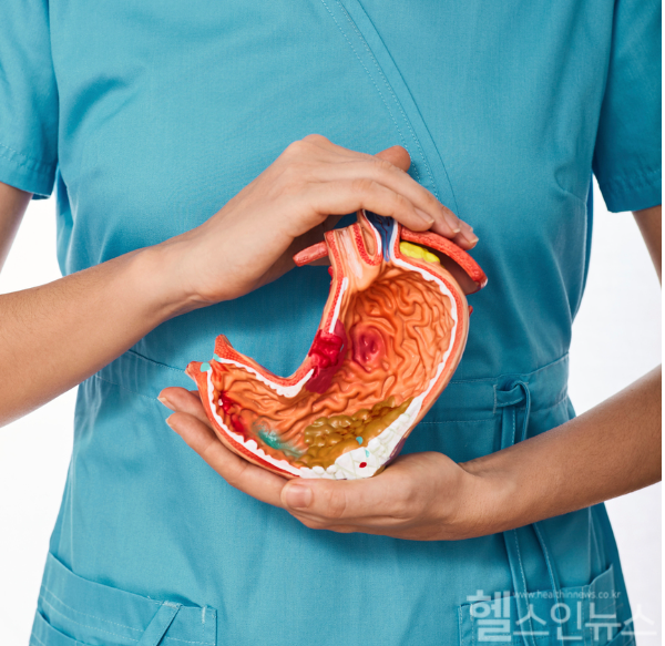 헬리코박터 감염에 따른 위궤양이 치매 발병 위험 3배나 높일 수 있어... 신속한 헬리코박터 제균치료 중요성 강조 (클립아트코리아)