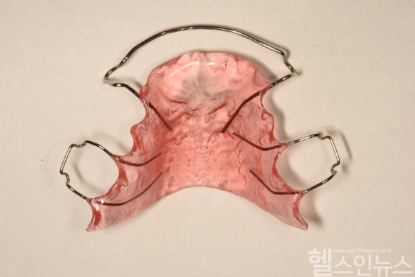 가철식 유지장치 모습 (서울대치과병원 제공)