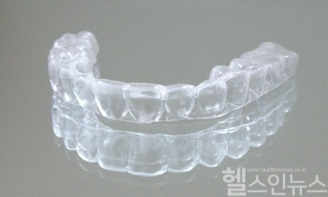 투명 가철식 유지장치 (서울대치과병원 제공)