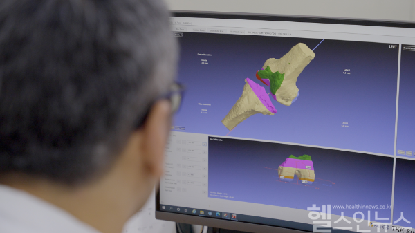 연세사랑병원 연구진이 MRI 무릎 관절 영상을 분석하고 있다. (연세사랑병원 제공)