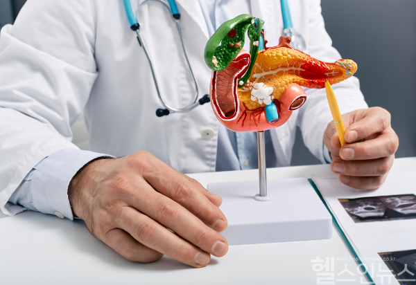 췌장에서 발견된 낭종(물혹), 무조건 췌장암으로 진행되진 않아... 성별 및 종류에 따라 암 발전 가능성 달라질 수 있어 정확한 검진 및 의료진과 상의 후 치료 계획 수립하는 것이 중요해 (클립아트코리아)