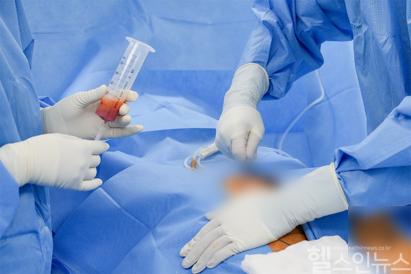 연세사랑병원 의료진이 환자의 수면마취 하에 환자 자신의 몸에 있는 지방조직을 채취하고 있다. (연세사랑병원 제공)