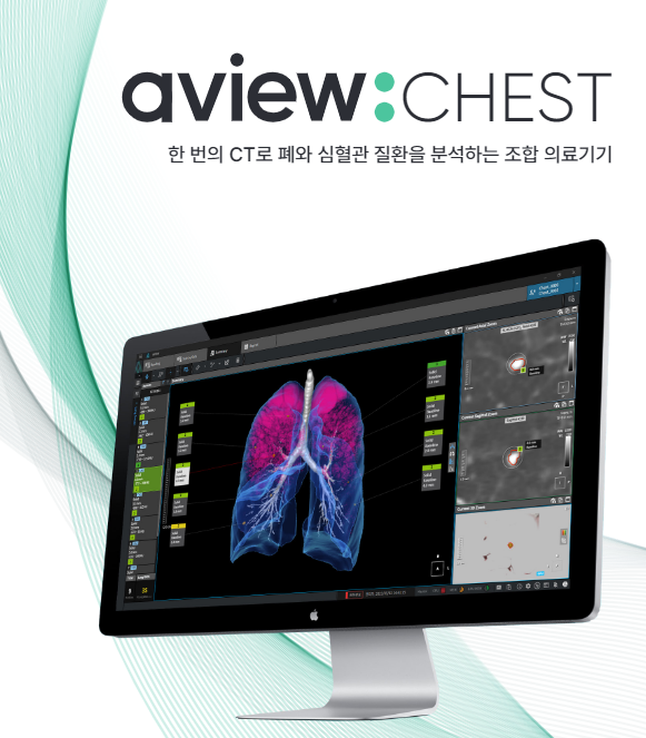 CHEST 이미지 (코어라인소프트 제공)