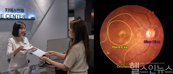 왼쪽부터) 시력교정술 후 정기검진차 지에스안과를 찾은 고객이 망막검사 레포트를 제공받고 있다. / 뷰노메드 펀더스 Ai 검사결과 화면. 각종 망막 질환의 범위와 증상이 표시된다. (지에스안과 제공)