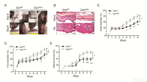 연구팀은 유전자 편집 기술을 이용하여 겔솔린이 결핍된 쥐와 정상 쥐에게 류마티스 관절염을 유도하고 염증 반응을 비교했다(A). 그 결과 겔솔린 결핍 쥐 그룹은 발과 발목에 부종이 더 심각하게 나타나는 관절염 증상을 보였으며, 염증성 사이토카인이 과도하게 분비됐다(B~E). (강남세브란스병원 제공)