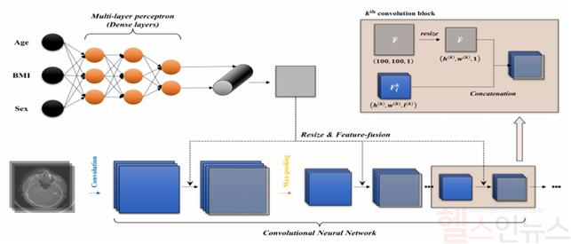 AirwayNet-MM-H 모델 구조: 정형 데이터(나이, 성별, BMI)를 처리하는 MLP와 비정형 데이터(CT 이미지)를 처리하는 CNN을 결합한 폐쇄성 수면무호흡증 진단 및 중증도 예측 모델 (서울대병원 제공)