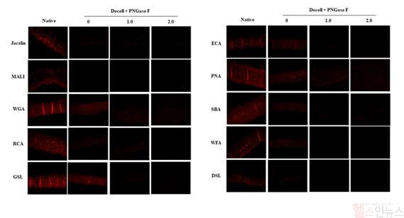 탈세포화(Decell)와 결합된 PNGase F 처리에 의해 탄수화물 결합 렉틴 발현이 현저히 감소하여, non-Gal 이종 항원 제거 효율이 증가함(적색 발현이 현저히 감소함) (서울대병원 제공)