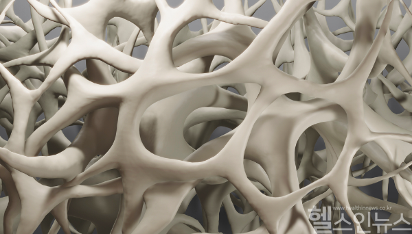 노화에 따른 자연스러운 증상으로 여기기 쉬운 골다공증, 골절되기 전까지 이렇다 할 자각 증상 없어... 예방법은 평소 건강한 생활 습관과 규칙적 운동, 올바른 식습관이 대표적 (클립아트코리아)