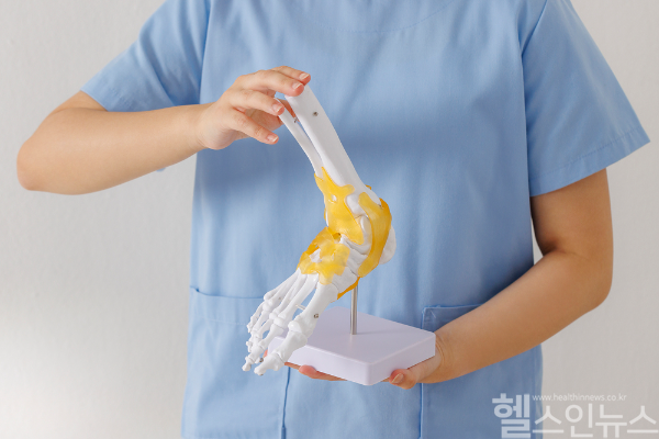 나이 불문, 젊은층도 안심할 수 없는 대표적인 관절질환 '발목 관절염'... 나이 보다 일상생활 중 염좌와 골절이 더 위험해 (클립아트코리아)