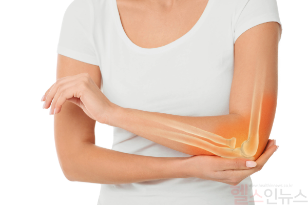 40대 이상 주부나 남성들, 손목 사용량이 많은 이들에게 흔히 나타날 수 있는 테니스엘보. 팔꿈치 관절 바깥에서 통증 느껴진다면 검사를 받아보는 게 좋다. (클립아트코리아)