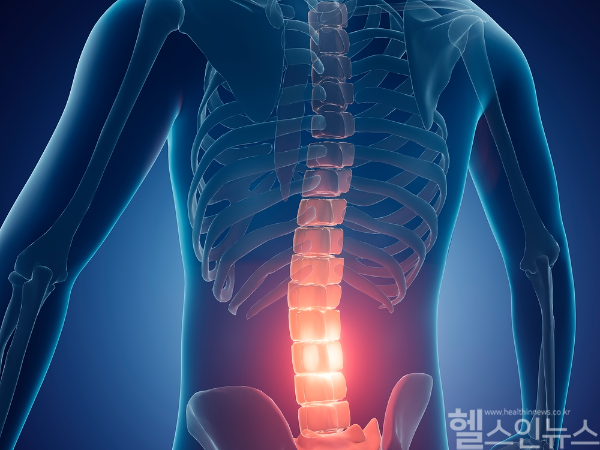 여러 가지 검사나 MRI 상에서도 별다른 신경 눌림이 보이지 않는데도 허리통증과 엉덩이 통증, 다리 저림 등의 증상이 있다면 근육성 방사통, 근육성 좌골신경통을 의심해 볼 수 있다. (클립아트코리아)