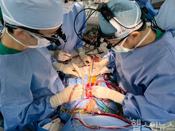 서울아산병원 심장혈관흉부외과 김호진 교수(오른쪽)가 ROSS수술을 하고 있다 (서울아산병원 제공)