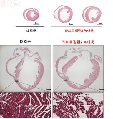 라트로필린-2 유전자 녹아웃 시 심장의 확장 및 심근세포 결합 약화로 인한 수축력 저하와 심부전 발생 (서울대병원 제공)