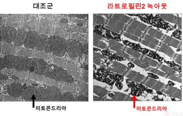 전자현미경 검사에서 라트로필린-2 녹아웃 시 심근섬유 분리 및 미토콘드리아 구조 손상: 라트로필린2 결손 심근세포는 대조군에 비해 심근섬유 간격이 벌어지고 미토콘드리아 구조가 파괴되어 에너지 생산 효율 저하와 수축력 감소로 심부전이 발생할 수 있음 (서울대병원 제공)