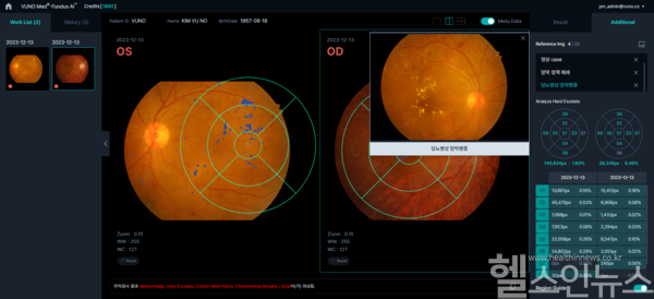 뷰노메드 펀더스 AI 운영화면 예시 (뷰노 제공)