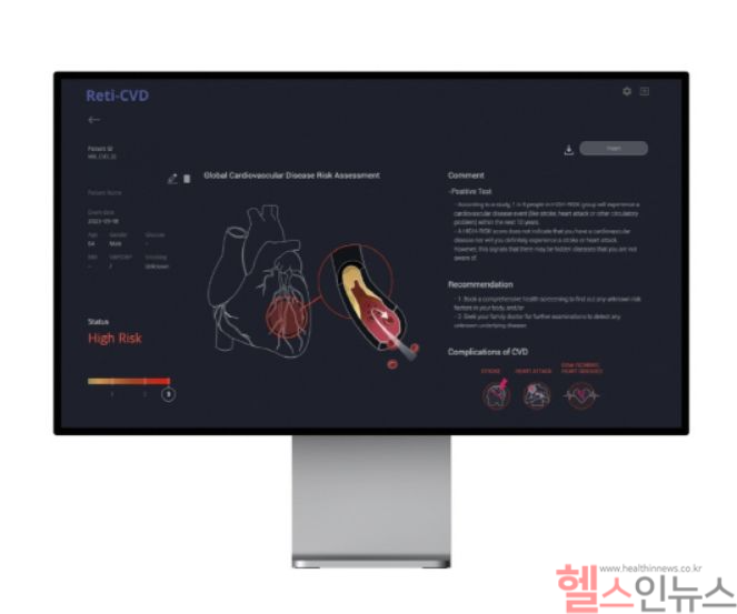 닥터눈 CVD (메디웨일 제공)