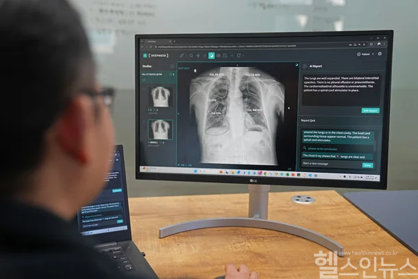 딥노이드 M4CXR은 생성형 AI를 기반으로 흉부 엑스레이(X-ray) 영상을 분석해 자동으로 판독문 초안을 생성하는 생성형 의료 AI 솔루션이다. (딥노이드 제공)