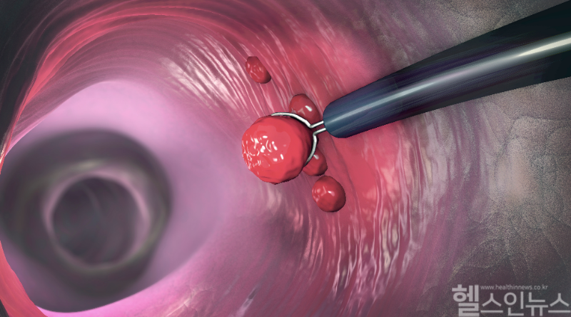 위 사진은 본문과 관계없음 (클립아트코리아 제공)