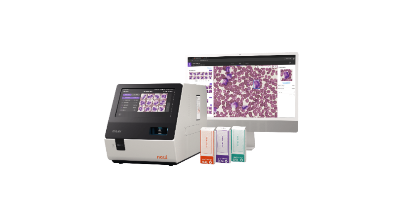 노을의 혈액 분석 제품(miLab™ BCM) 이미지 (노을 제공)