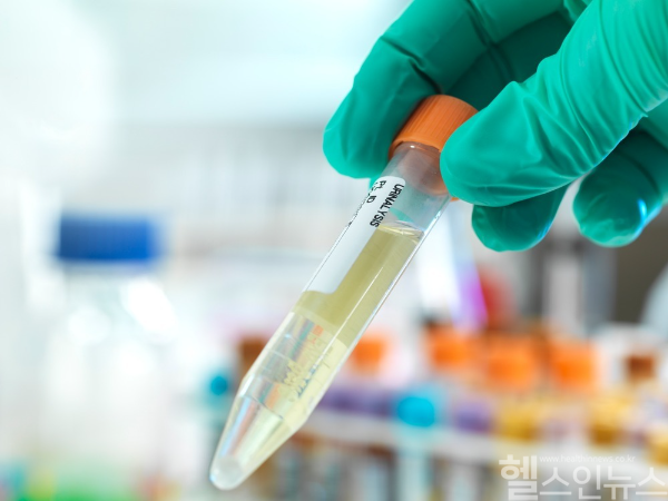 다양한 원인으로 발생할 수 있는 혈뇨, 일시적일 수도 있지만 신장과 요도, 방광 건강의 이상 신호일 수 있어 잘 살펴보는 것이 좋다. (클립아트코리아)