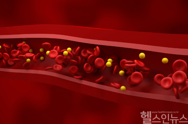 신장 기능이 떨어질 때 고려할 수 있는 혈액 투석 치료. 이때 투석용 혈관인 동정맥루가 필요하다. (클립아트코리아)