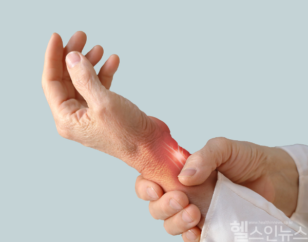 스마트폰 사용량 많고 손동작이 많은 직업군에게 흔한 손목터널증후군, 자주 손 저리고 힘 빠지는 증상 있다면 의심해 봐야 (클립아트코리아)