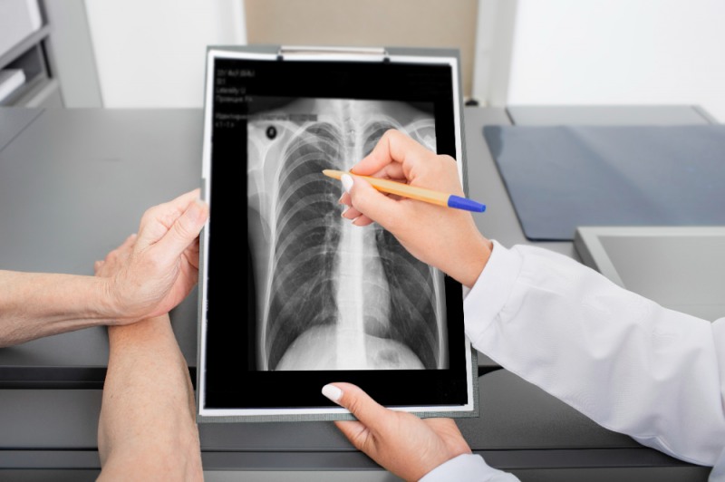 기침이 멈추지 않고 흉통이 이어진다면 감기나 독감이 아닌 '폐렴'을 의심해야 한다. 호흡기 바이러스들이 울철 약해진 면역력을 뚫고 들어와 폐렴을 유발할 수 있다. (클립아트코리아 제공)