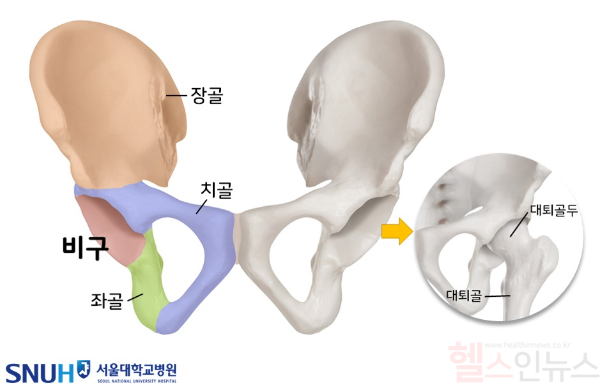 정면에서 바라본 골반뼈, 골반뼈 구조 (서울대학교병원 제공)